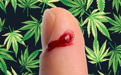 Cannabis Oil Helps Skin Wounds and Cuts Heal Faster According to New Skin Research Report