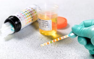 How to Pass A Drug Test: Employers Are Still Testing People For Marijuana