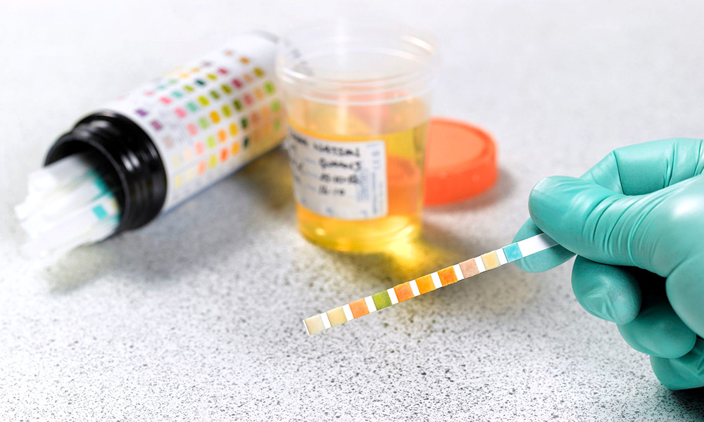 How to Pass A Drug Test: Employers Are Still Testing People For Marijuana